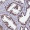 Zinc Finger Protein 280A antibody, NBP1-92459, Novus Biologicals, Immunohistochemistry paraffin image 