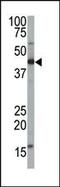 Farnesyltransferase, CAAX Box, Alpha antibody, PA5-12169, Invitrogen Antibodies, Western Blot image 