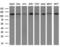 Poly(ADP-ribose) glycohydrolase antibody, LS-C794443, Lifespan Biosciences, Western Blot image 