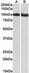 Clock Circadian Regulator antibody, orb137114, Biorbyt, Western Blot image 