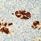 Adenovirus antibody, LS-C87500, Lifespan Biosciences, Immunohistochemistry paraffin image 