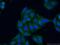 Phosphoserine Phosphatase antibody, 14513-1-AP, Proteintech Group, Immunofluorescence image 