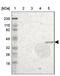 Zinc Finger DHHC-Type Containing 15 antibody, NBP1-82014, Novus Biologicals, Western Blot image 