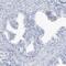 Formyl Peptide Receptor 2 antibody, PA5-56076, Invitrogen Antibodies, Immunohistochemistry frozen image 