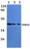 Cytochrome C Oxidase Assembly Homolog COX15 antibody, PA5-75858, Invitrogen Antibodies, Western Blot image 