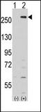 Serine/threonine-protein kinase LMTK2 antibody, AP13773PU-N, Origene, Western Blot image 