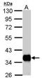 Pyruvate Dehydrogenase E1 Beta Subunit antibody, PA5-27989, Invitrogen Antibodies, Western Blot image 