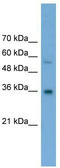 UDP-Galactose-4-Epimerase antibody, TA334925, Origene, Western Blot image 