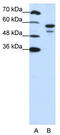 U2 Small Nuclear RNA Auxiliary Factor 2 antibody, TA345731, Origene, Western Blot image 