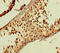 Disrupted In Renal Carcinoma 1 antibody, LS-C397599, Lifespan Biosciences, Immunohistochemistry paraffin image 