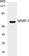 Matrix Metallopeptidase 3 antibody, EKC1381, Boster Biological Technology, Western Blot image 