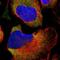 Partitioning defective 6 homolog beta antibody, PA5-53050, Invitrogen Antibodies, Immunofluorescence image 
