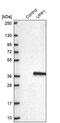 Uridine Phosphorylase 1 antibody, PA5-63120, Invitrogen Antibodies, Western Blot image 