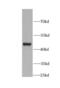 Keratin-19 antibody, FNab02207, FineTest, Western Blot image 