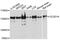 Coiled-Coil And C2 Domain Containing 1A antibody, PA5-76533, Invitrogen Antibodies, Western Blot image 