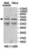 Activin receptor type IIA antibody, orb78277, Biorbyt, Western Blot image 