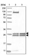 Mediator Complex Subunit 8 antibody, PA5-55829, Invitrogen Antibodies, Western Blot image 