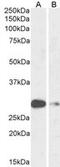 HASH1 antibody, GTX01090, GeneTex, Western Blot image 