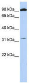 Metabotropic glutamate receptor 6 antibody, TA344497, Origene, Western Blot image 
