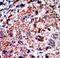 6-phosphofructokinase, liver type antibody, LS-C101261, Lifespan Biosciences, Immunohistochemistry paraffin image 