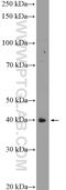 Tropomodulin-1 antibody, 10145-1-AP, Proteintech Group, Western Blot image 