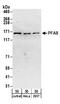 Phosphoribosylformylglycinamidine Synthase antibody, A304-218A, Bethyl Labs, Western Blot image 