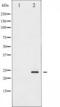 BCL2 Associated Agonist Of Cell Death antibody, TA325254, Origene, Western Blot image 