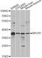 Ribosomal Protein Lateral Stalk Subunit P0 antibody, A13633, ABclonal Technology, Western Blot image 