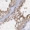 Acrosin Binding Protein antibody, NBP1-85408, Novus Biologicals, Immunohistochemistry frozen image 