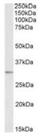 Microtubule-associated protein RP/EB family member 3 antibody, AP10053PU-N, Origene, Western Blot image 