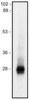 Lck-interacting transmembrane adapter 1 antibody, NBP1-47230, Novus Biologicals, Western Blot image 