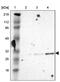Chromosome X Open Reading Frame 21 antibody, PA5-51531, Invitrogen Antibodies, Western Blot image 