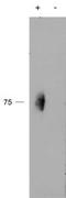 CD244 antibody, TA311457, Origene, Western Blot image 