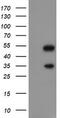 Zinc finger protein SNAI2 antibody, M01615-1, Boster Biological Technology, Western Blot image 