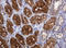 D-Dopachrome Tautomerase antibody, LS-C174459, Lifespan Biosciences, Immunohistochemistry paraffin image 