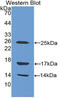 Cathelicidin Antimicrobial Peptide antibody, MBS2001396, MyBioSource, Western Blot image 