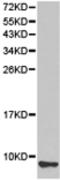 Ubiquitin-40S ribosomal protein S27a antibody, TA323865, Origene, Western Blot image 