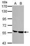 Hematopoietic Cell-Specific Lyn Substrate 1 antibody, PA5-27156, Invitrogen Antibodies, Western Blot image 