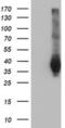 LRAT Domain Containing 2 antibody, MA5-25310, Invitrogen Antibodies, Western Blot image 