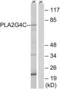 Phospholipase A2 Group IVC antibody, LS-C119896, Lifespan Biosciences, Western Blot image 