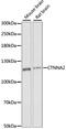 Catenin alpha-2 antibody, LS-C750237, Lifespan Biosciences, Western Blot image 