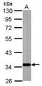 Solute Carrier Family 25 Member 22 antibody, NBP1-33385, Novus Biologicals, Western Blot image 