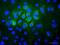 Keratin 7 antibody, ab9021, Abcam, Immunofluorescence image 