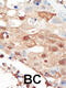 Phosphoinositide-3-Kinase Regulatory Subunit 2 antibody, 63-350, ProSci, Immunohistochemistry paraffin image 