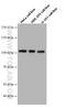 Anillin Actin Binding Protein antibody, 66643-1-Ig, Proteintech Group, Western Blot image 