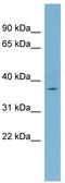 XIAP Associated Factor 1 antibody, TA344995, Origene, Western Blot image 