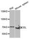 Carboxyl Ester Lipase antibody, A7652, ABclonal Technology, Western Blot image 