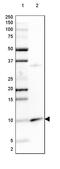 PET117 antibody, PA5-61574, Invitrogen Antibodies, Western Blot image 