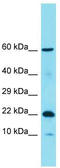 Chromosome 11 Open Reading Frame 87 antibody, TA334907, Origene, Western Blot image 