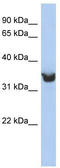 Pref-1 antibody, TA339381, Origene, Western Blot image 